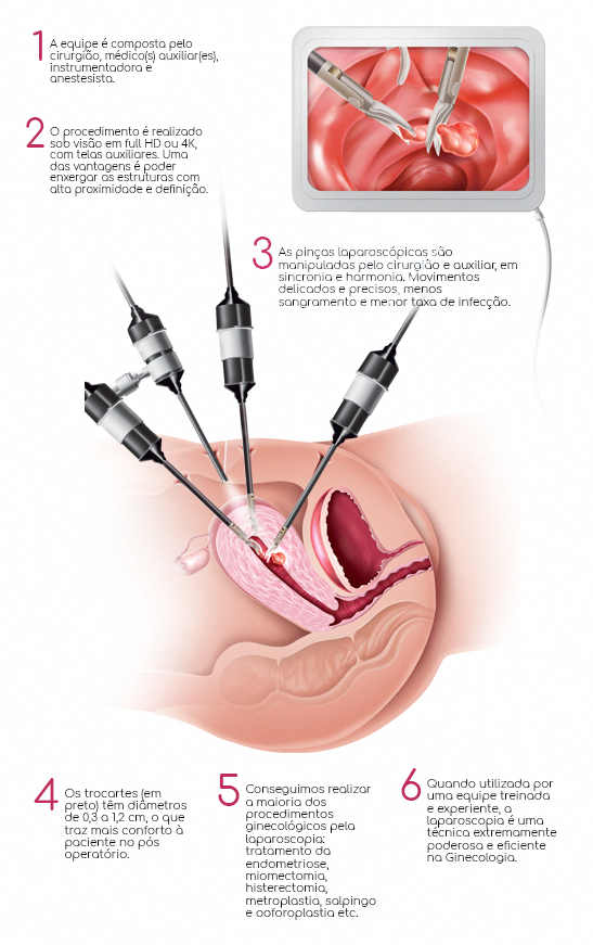 Cirurgia minimamente invasiva